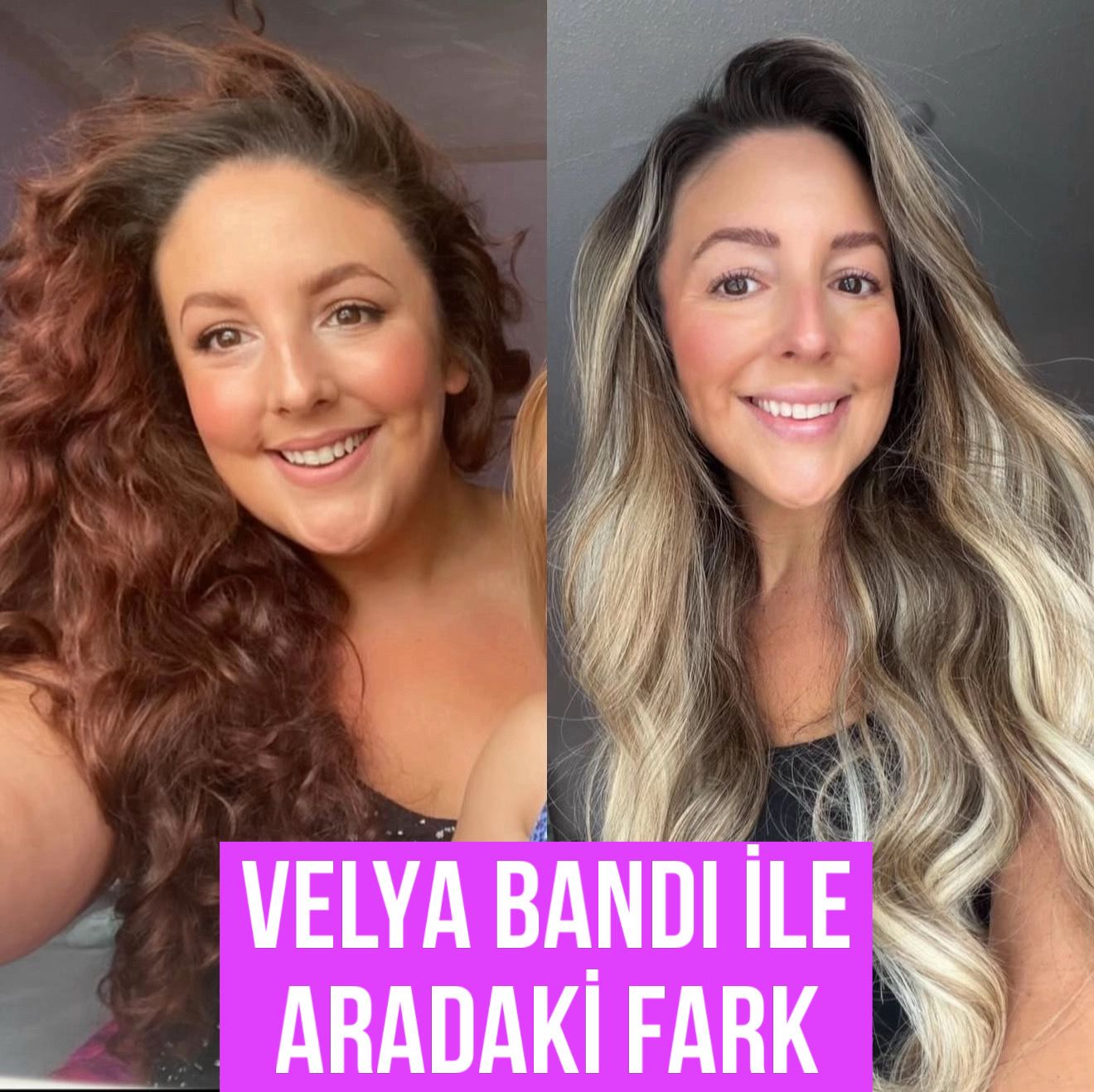Zayıflama Diyet Bandı