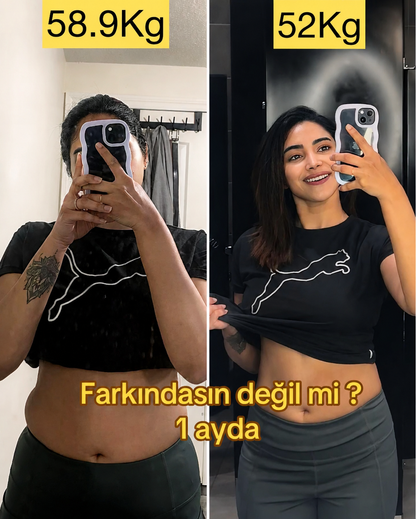 1 Alana 1 Bedava - Velya Göbek ve Bel Form Bandı – 30 Adet